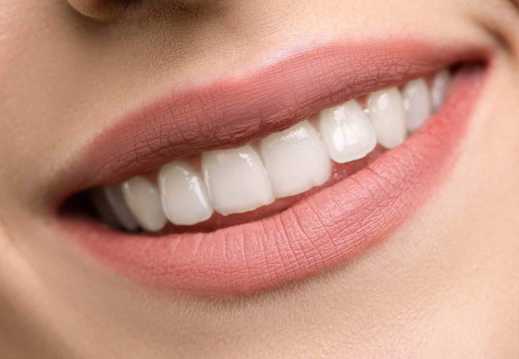 Bleaching-der-Zähne--5-Wichtige-Punkte-für-die-Nachbehandlung,-die-Sie-wissen-müssen